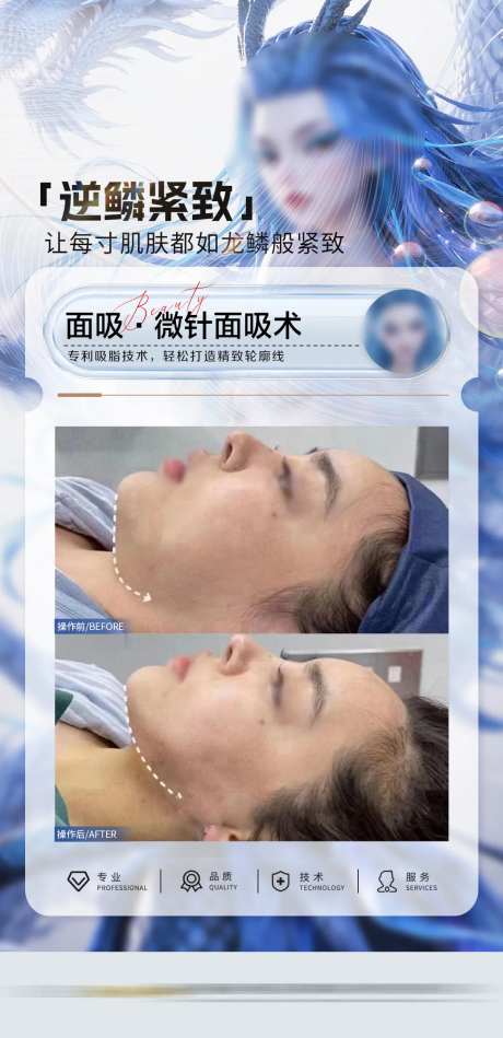 医美案例哪吒敖闰-采灵感-https://www.cailinggan.com/