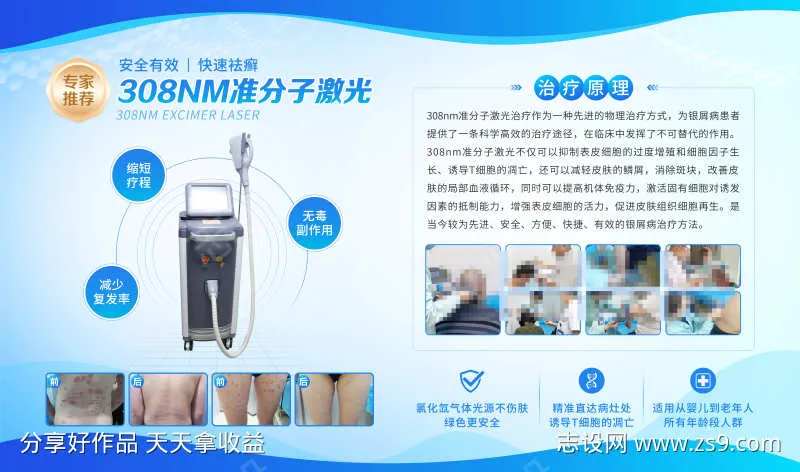 308NM准分子激光展架-采灵感-cailinggan.com