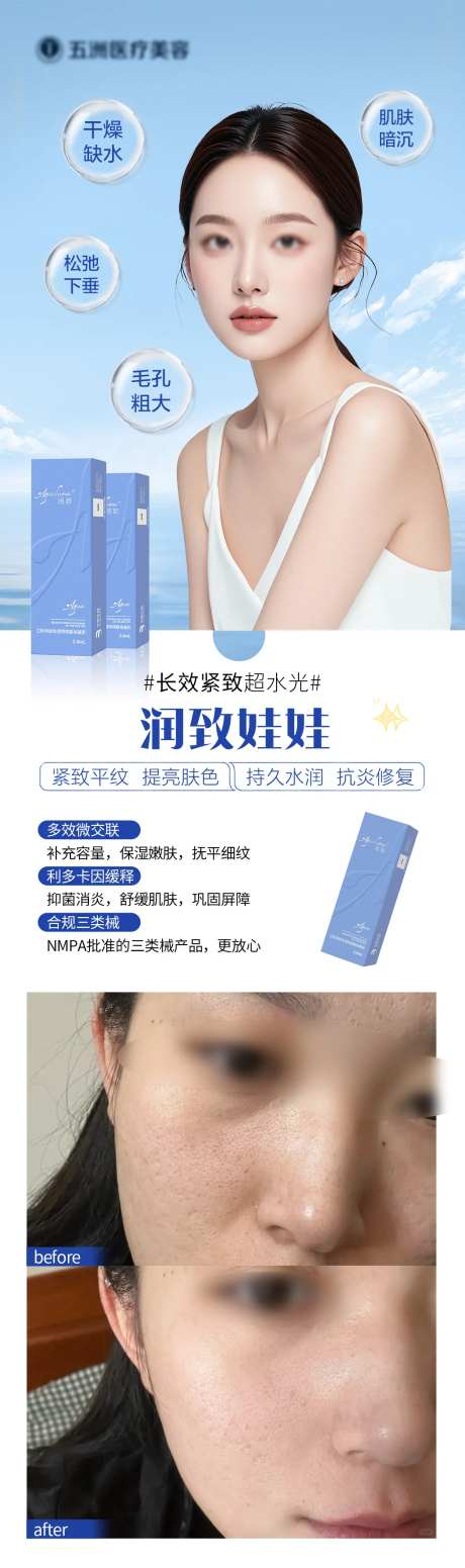 医美润致娃娃针案例海报-采灵感-https://www.cailinggan.com/