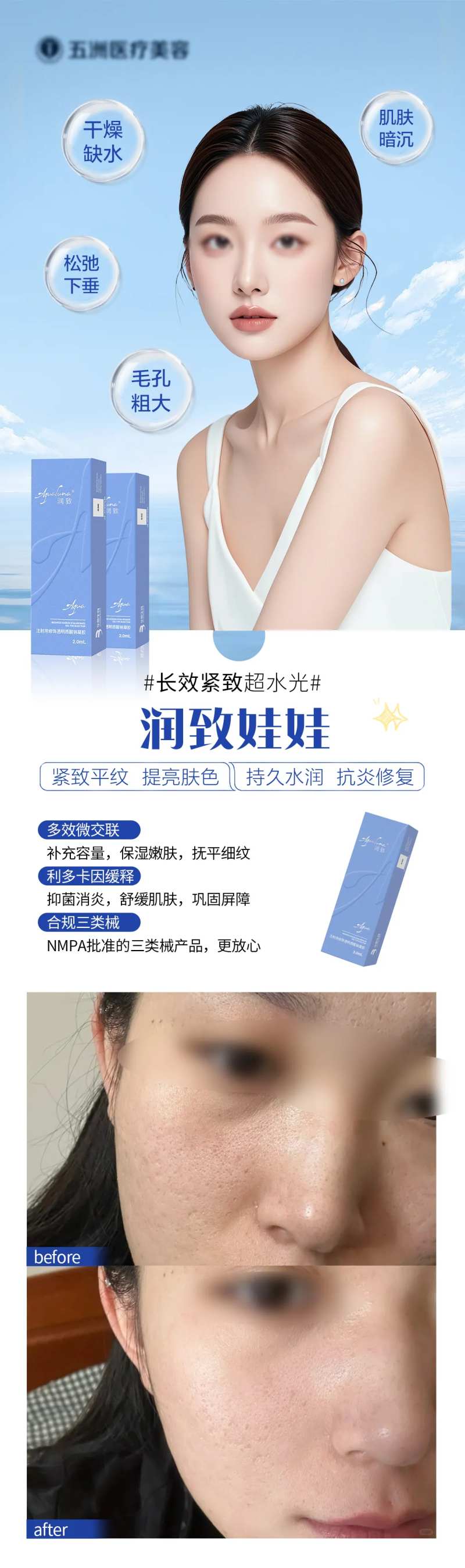 医美润致娃娃针案例海报-采灵感-cailinggan.com