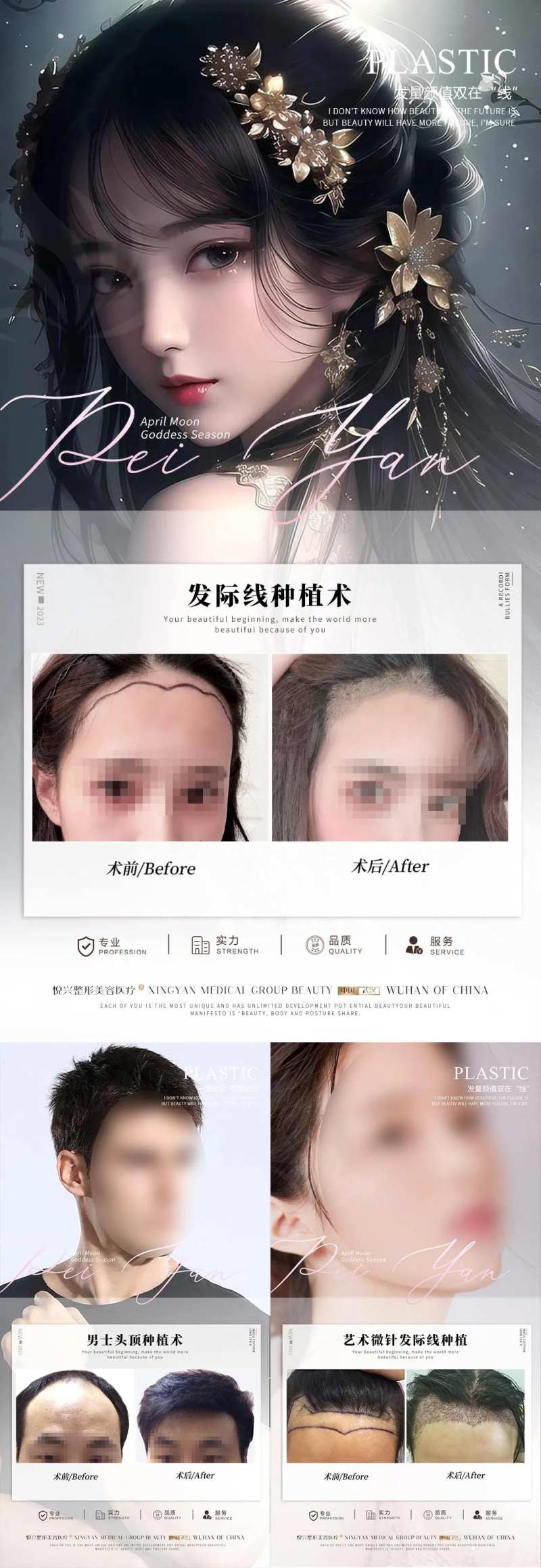 植发案例对比-采灵感-cailinggan.com