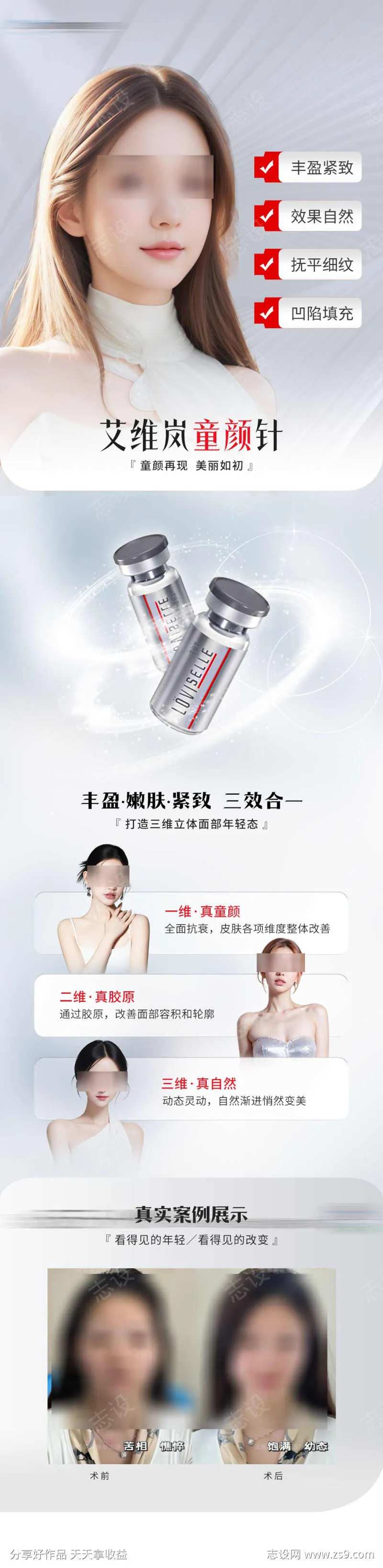 医美艾维岚童颜针                                                                                                                                                                                                -采灵感-cailinggan.com