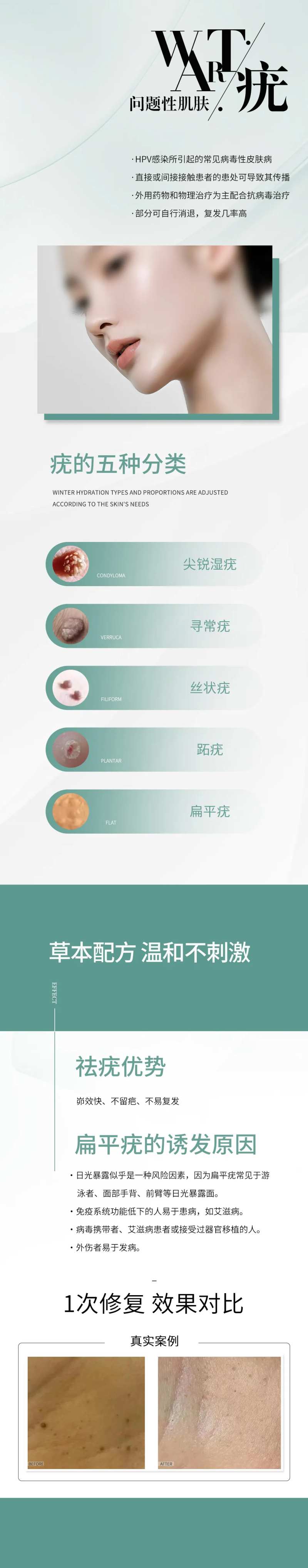 问题肌肤疣病毒-采灵感-cailinggan.com