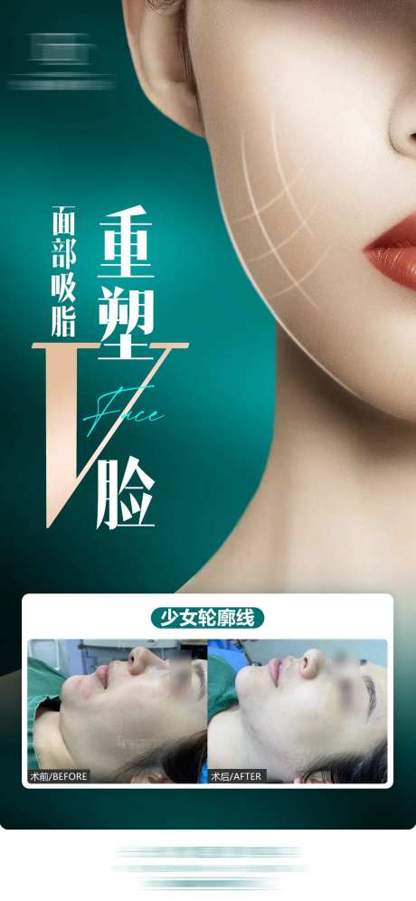 重塑v脸案例海报-采灵感-https://www.cailinggan.com/
