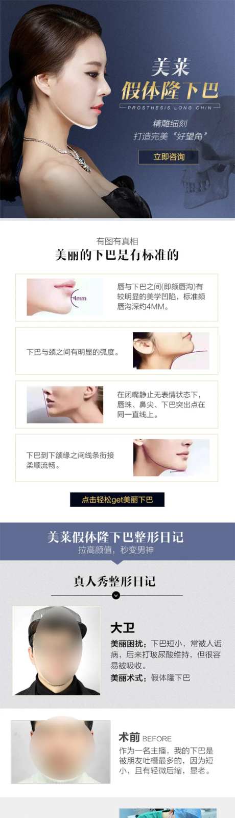 医美假体隆下巴技术电商详情页-采灵感-https://www.cailinggan.com/