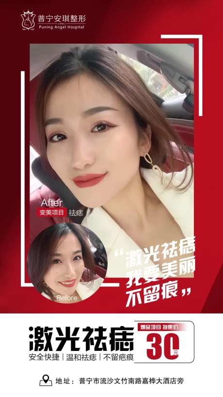 祛痣医美整形海报-采灵感-https://www.cailinggan.com/