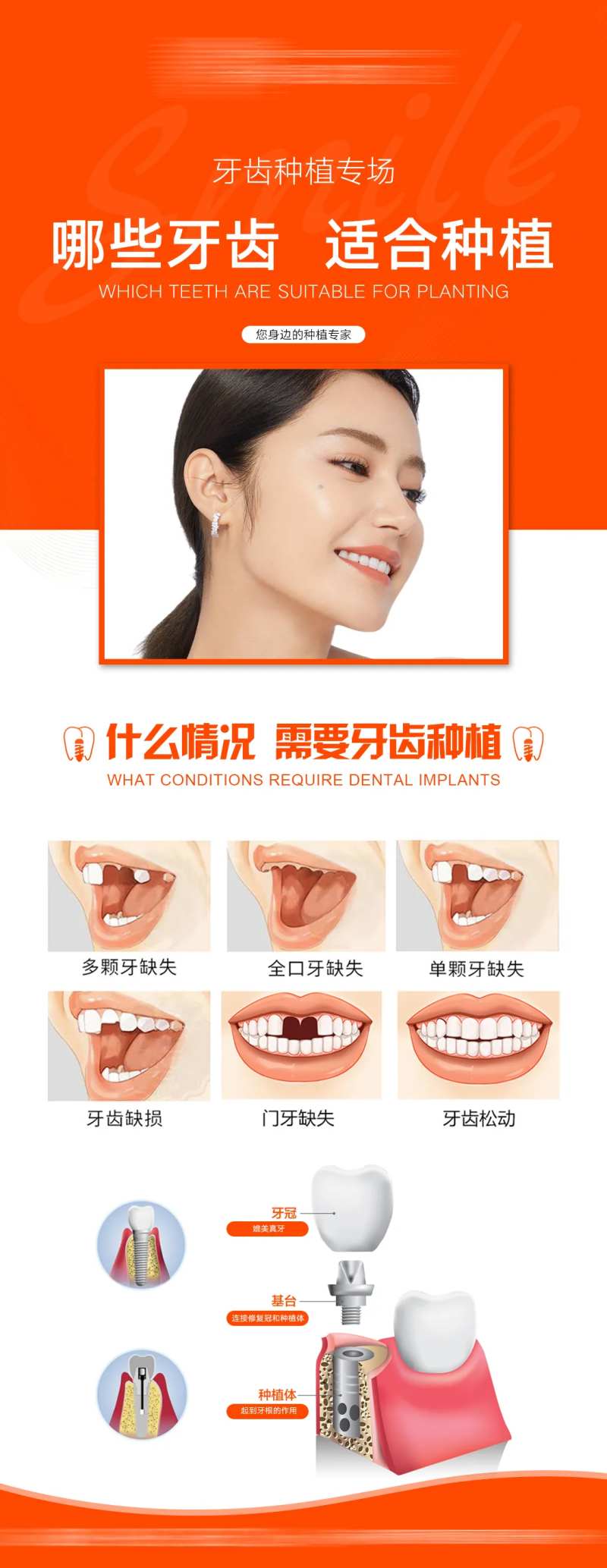 牙齿种植长图海报-采灵感-cailinggan.com