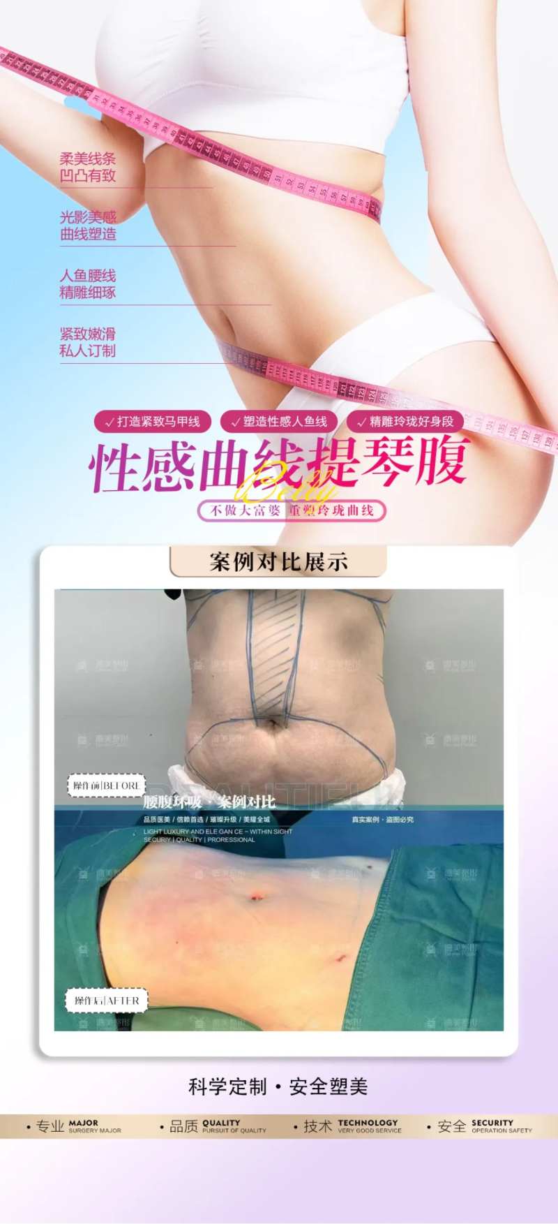 腰腹吸脂案例-采灵感-cailinggan.com