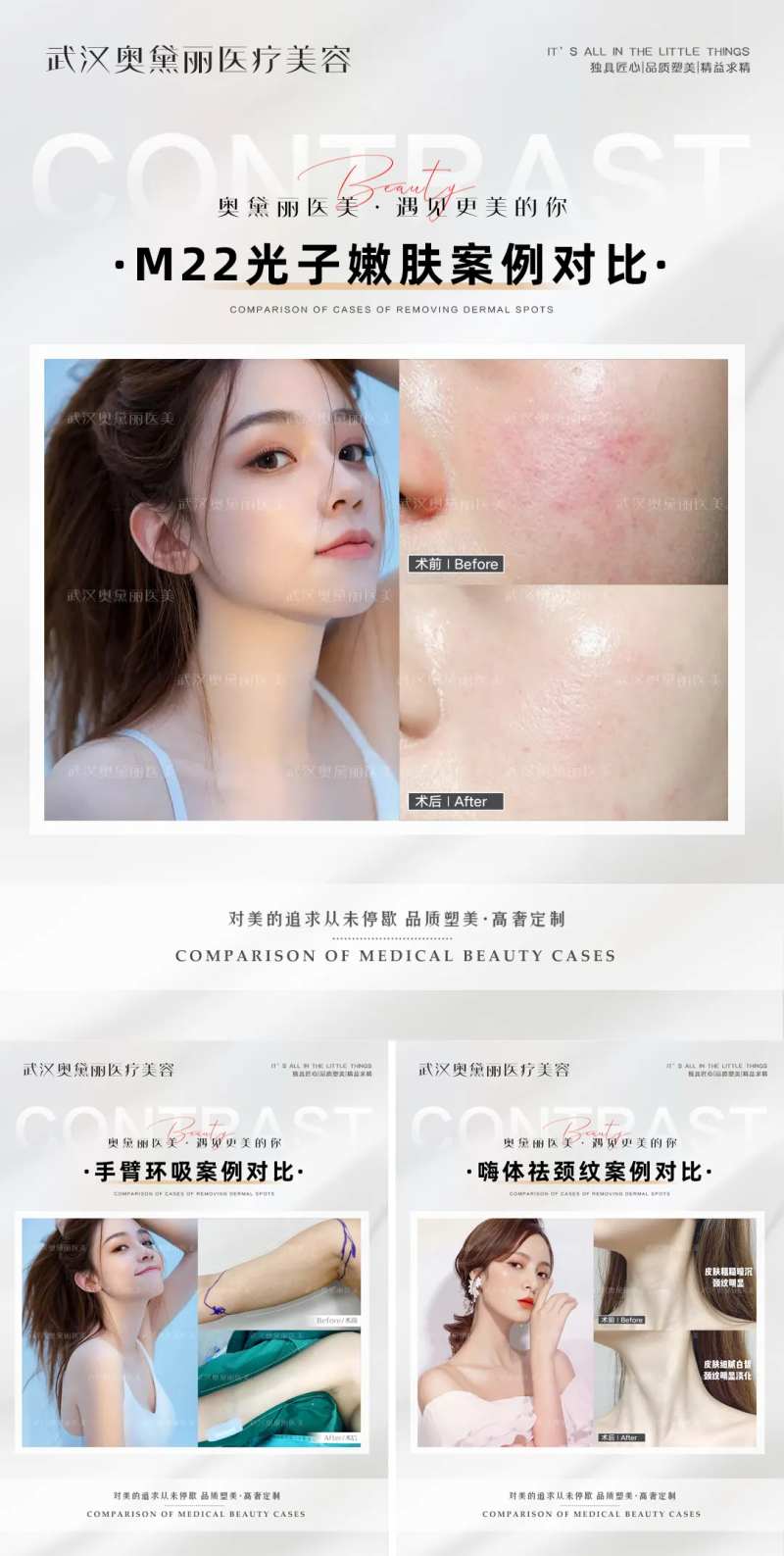 医美整形案例对比-采灵感-cailinggan.com