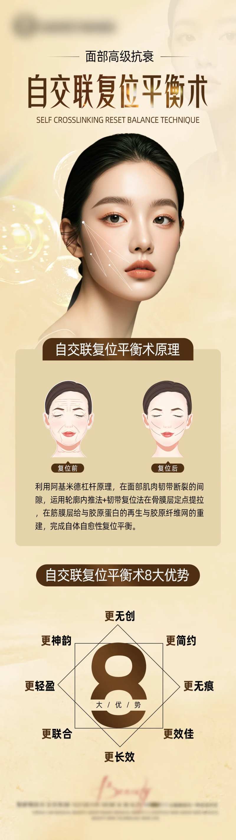 自交联复位平衡术-采灵感-cailinggan.com