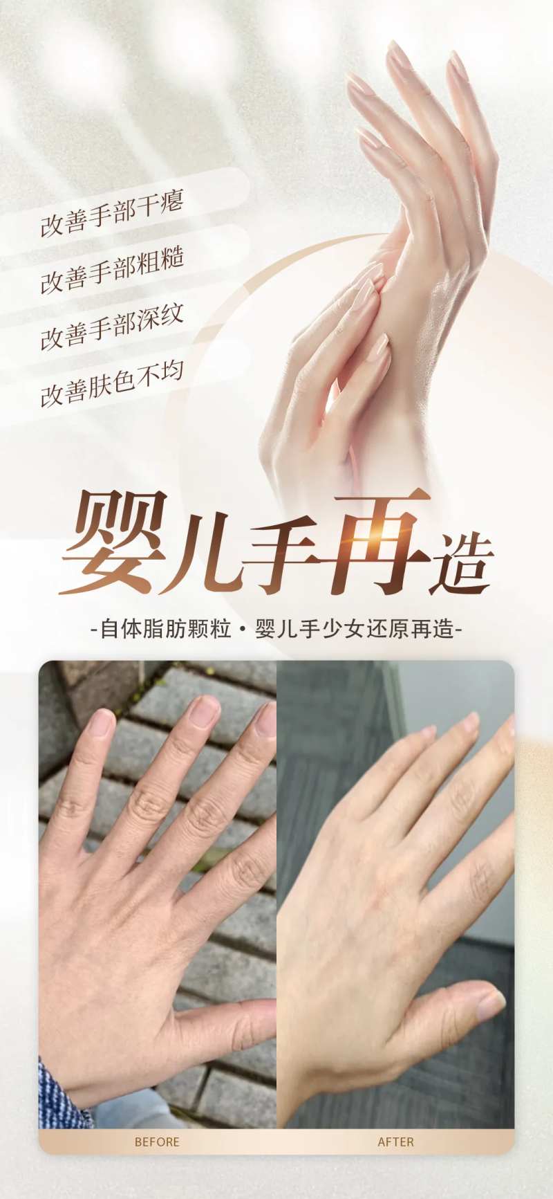 美业手部年轻化案例海报-采灵感-cailinggan.com