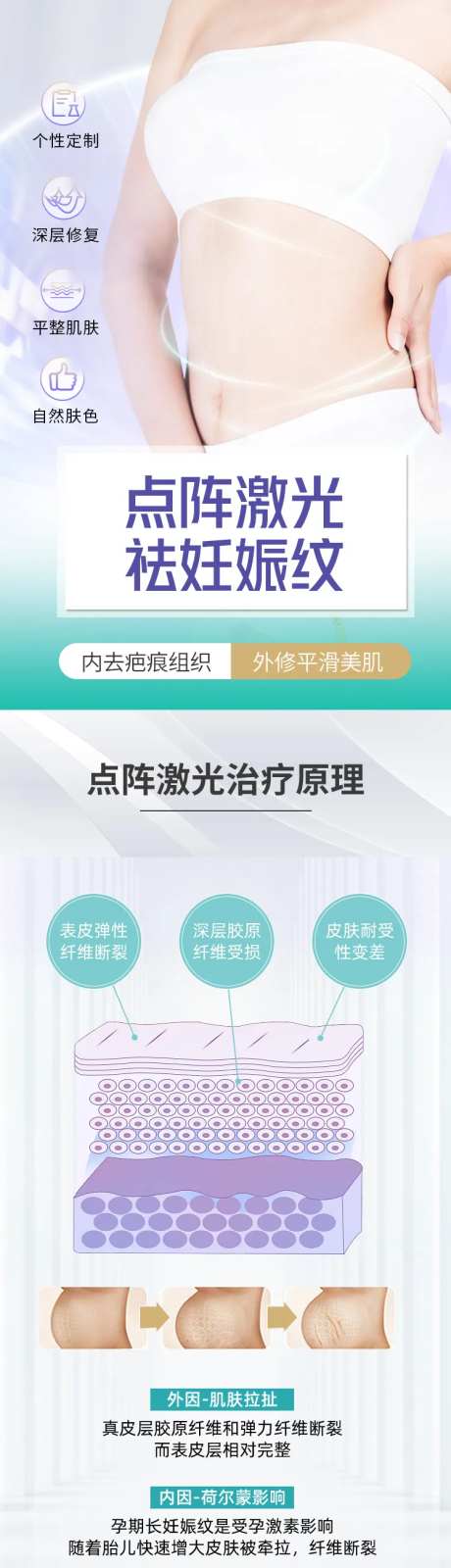 医美点阵激光祛妊娠纹详情页-采灵感-https://www.cailinggan.com/