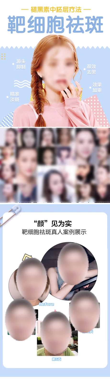医美靶细胞祛斑详情页-采灵感-https://www.cailinggan.com/