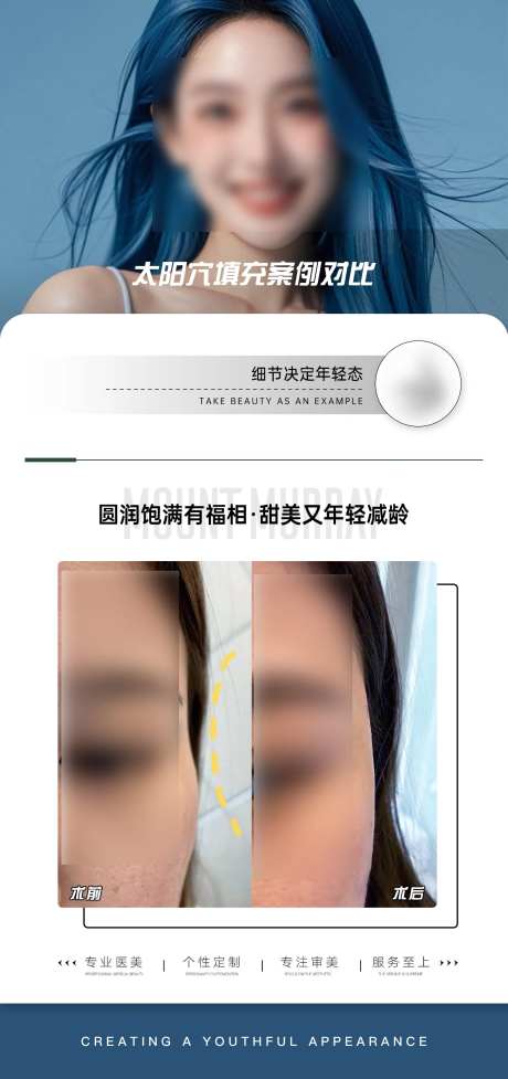 医美太阳穴填充案例对比海报-采灵感-https://www.cailinggan.com/