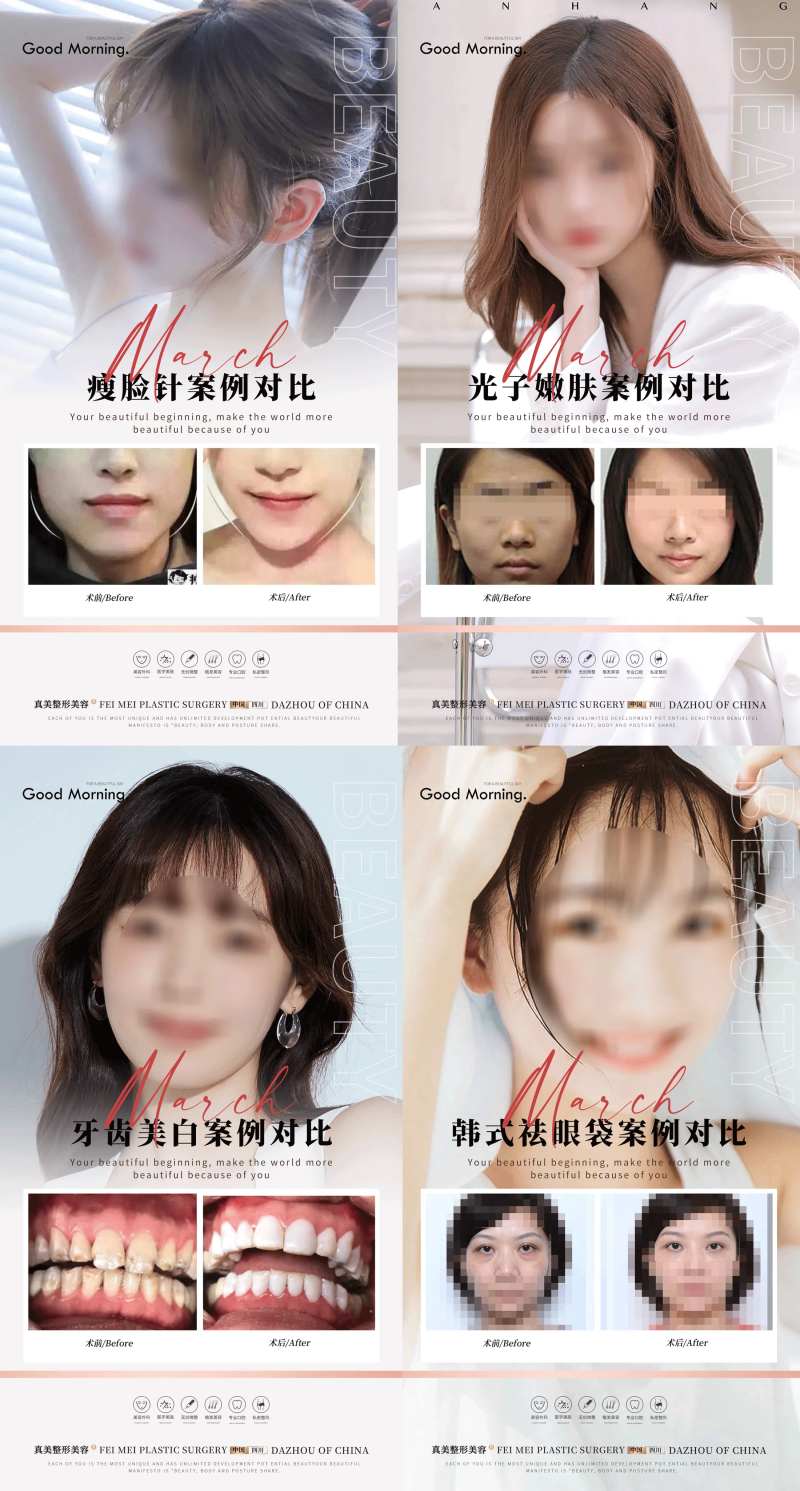 医美整形口腔案例合集-采灵感-cailinggan.com