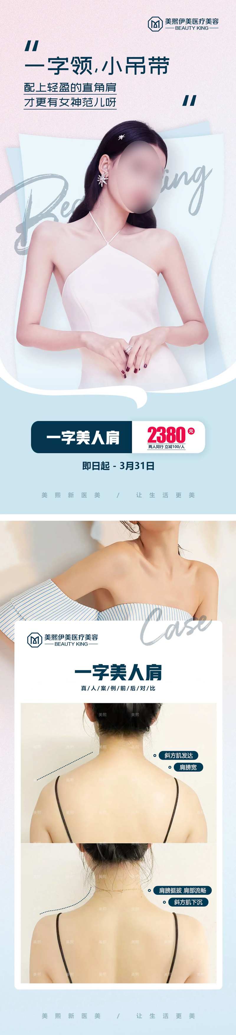 瘦肩针项目宣传长图-采灵感-cailinggan.com