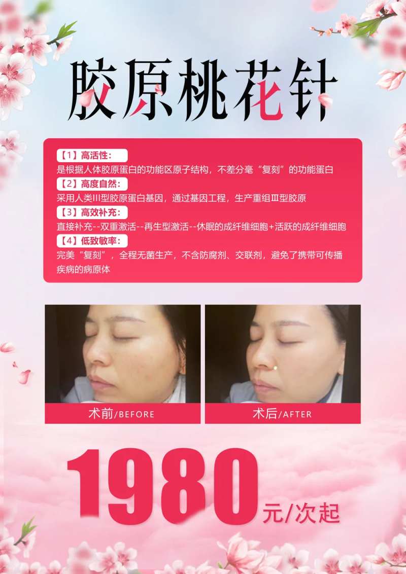 胶原桃花针案例对比海报-采灵感-cailinggan.com