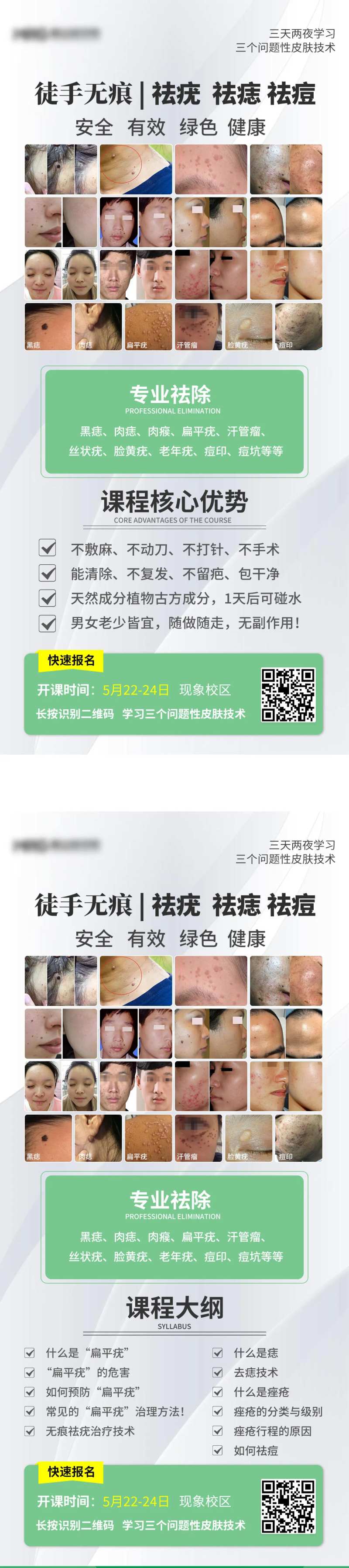 医美祛痘祛疣案例宣传海报-采灵感-cailinggan.com