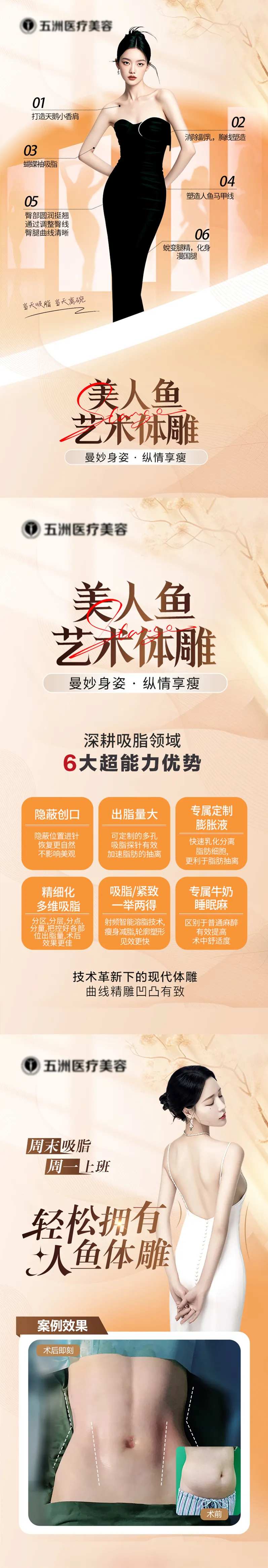 医美吸脂人鱼体雕-采灵感-cailinggan.com