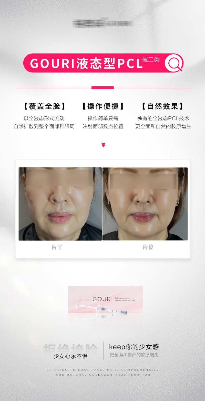 胶原蛋白胶原刺激再生pcl刺激-采灵感-cailinggan.com
