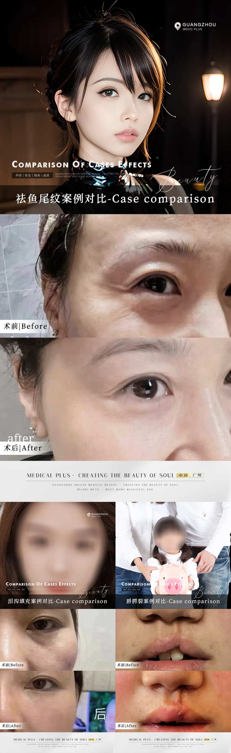 最新医美案例系列海报-采灵感-cailinggan.com