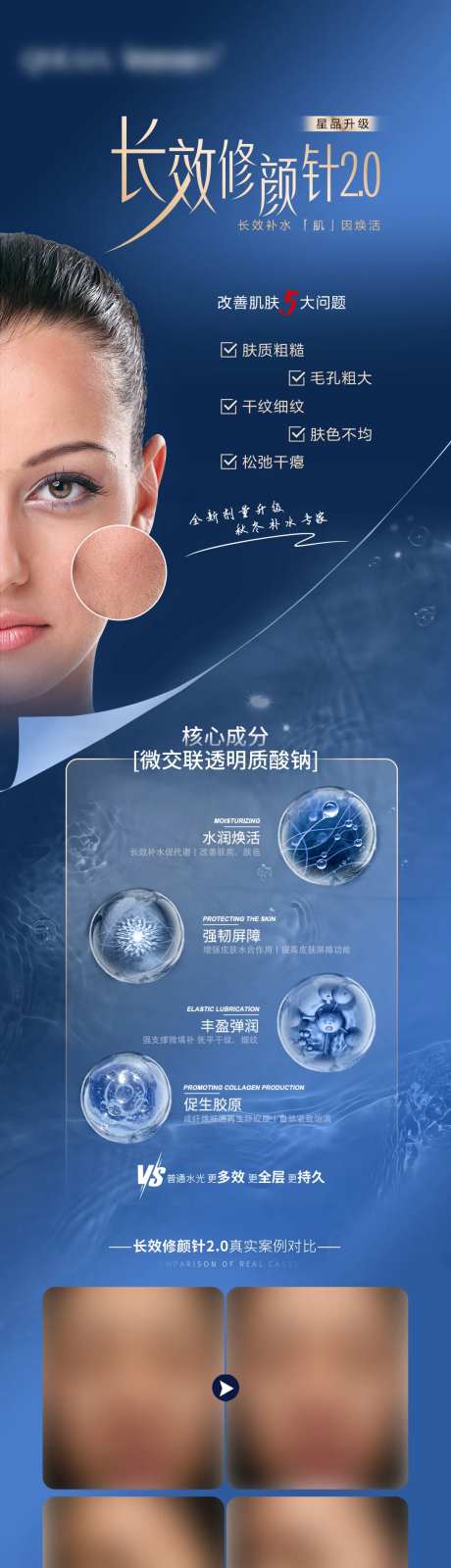 透明质酸钠长图海报-采灵感-https://www.cailinggan.com/