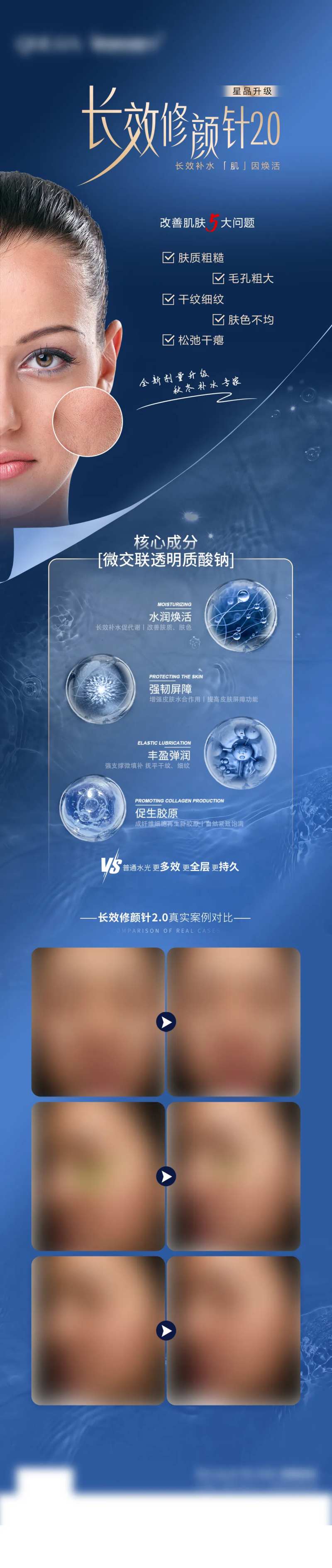 透明质酸钠长图海报-采灵感-cailinggan.com