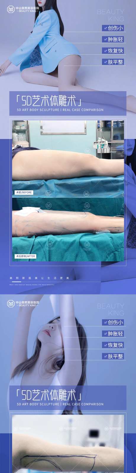 医美体雕吸脂案例海报-采灵感-https://www.cailinggan.com/