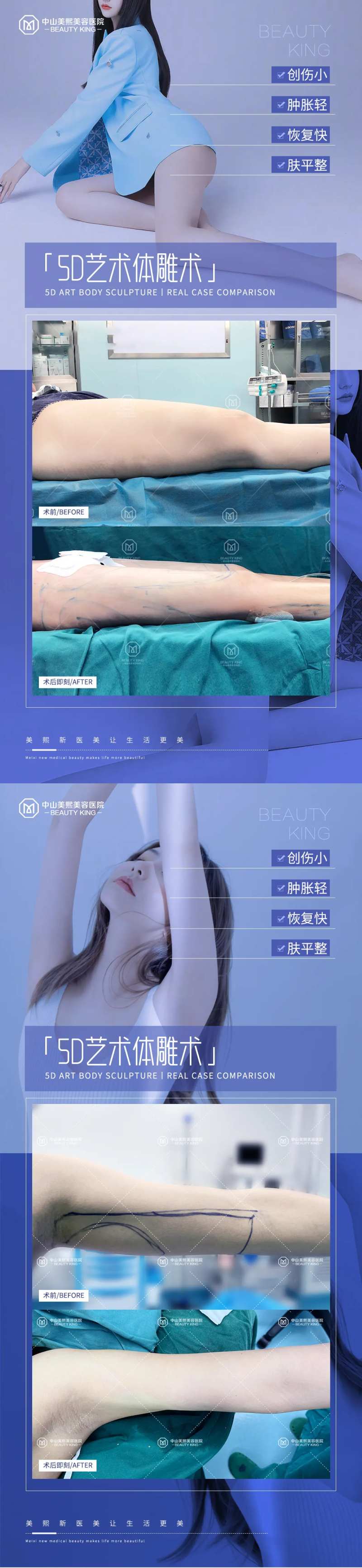 医美体雕吸脂案例海报-采灵感-cailinggan.com