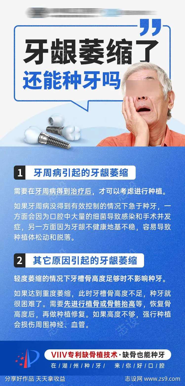 牙龈萎缩种植牙科普-采灵感-cailinggan.com