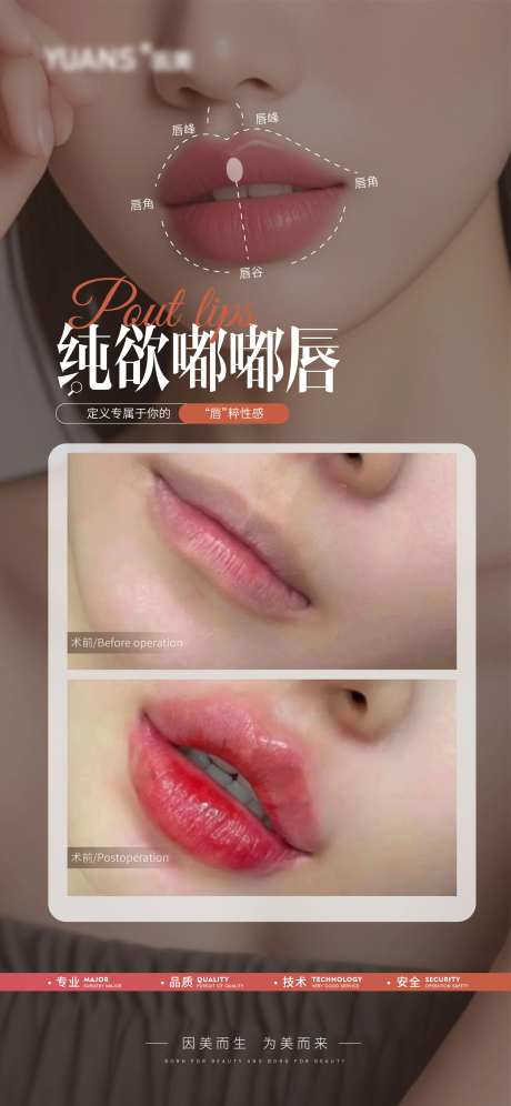 医美嘟嘟唇口周案例海报-采灵感-https://www.cailinggan.com/