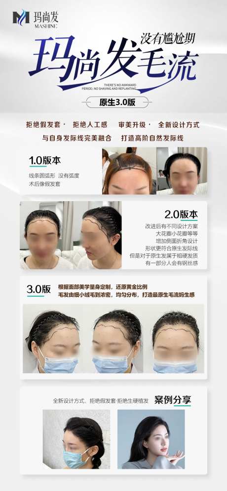 植发生发案例海报-采灵感-https://www.cailinggan.com/