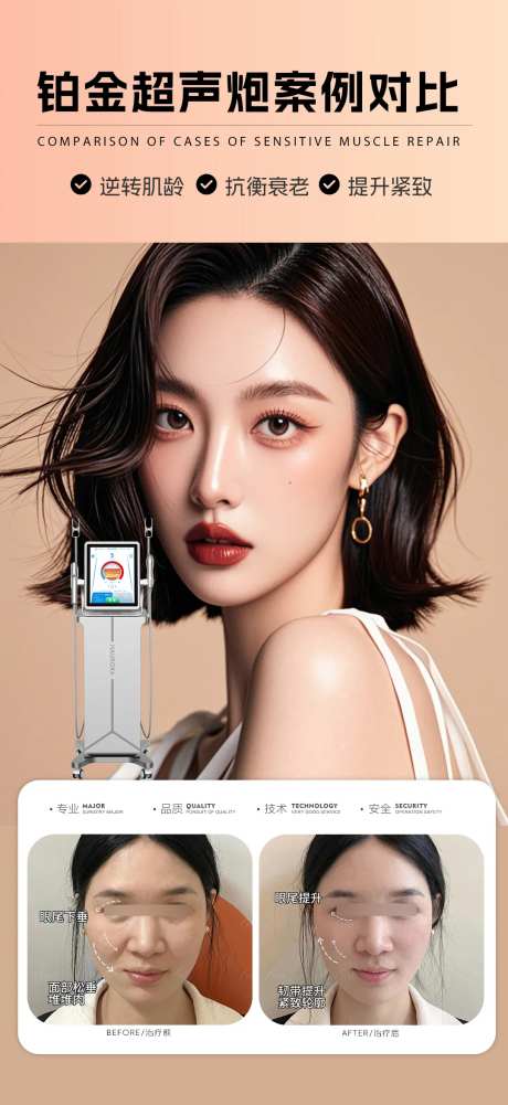 铂金超声炮抗衰案例海报-采灵感-https://www.cailinggan.com/