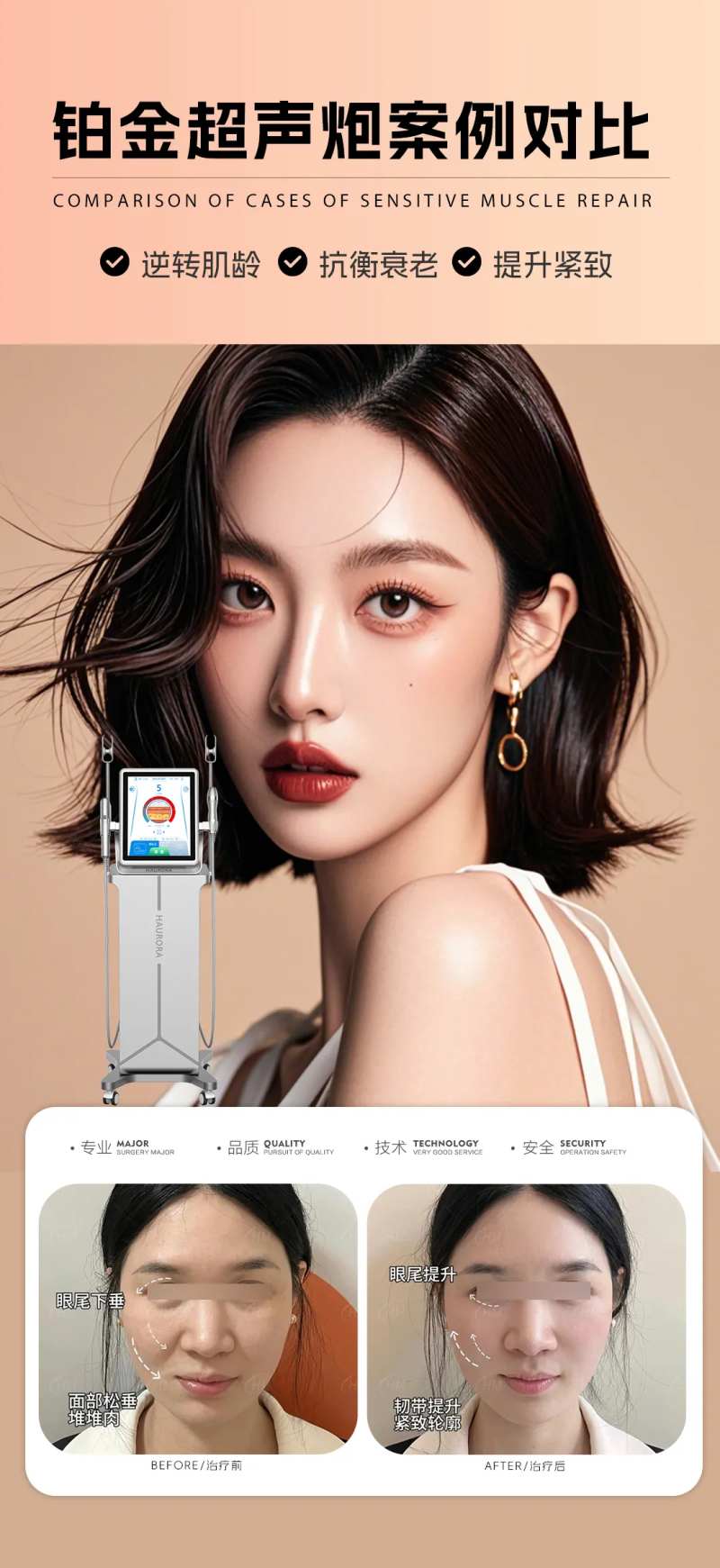 铂金超声炮抗衰案例海报-采灵感-cailinggan.com