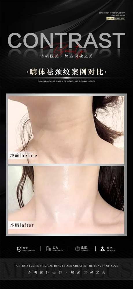 去颈纹案例对比海报-采灵感-https://www.cailinggan.com/