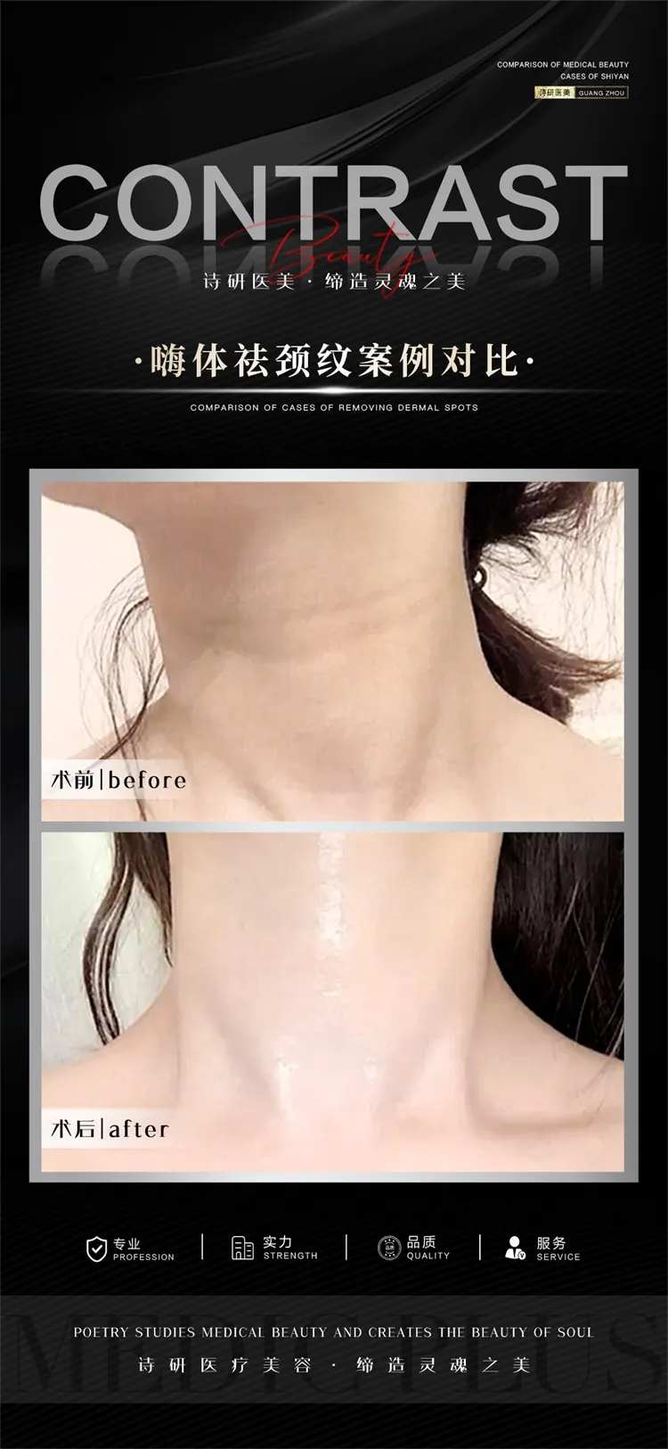 去颈纹案例对比海报-采灵感-cailinggan.com