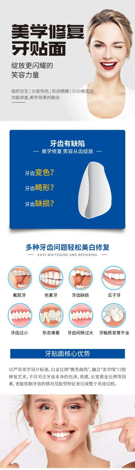 牙齿贴面详情页-采灵感-https://www.cailinggan.com/