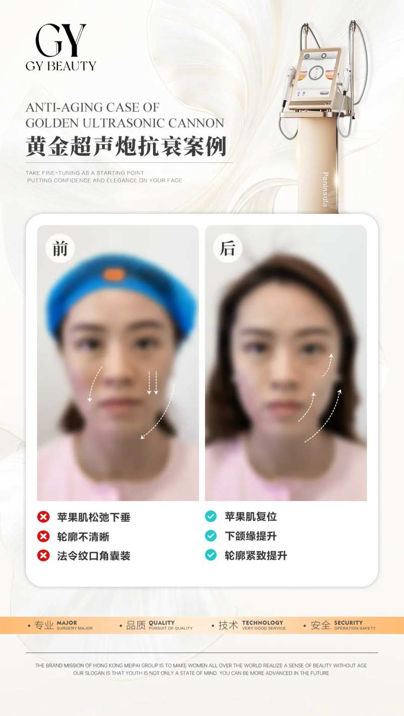 医美对比案例-采灵感-cailinggan.com