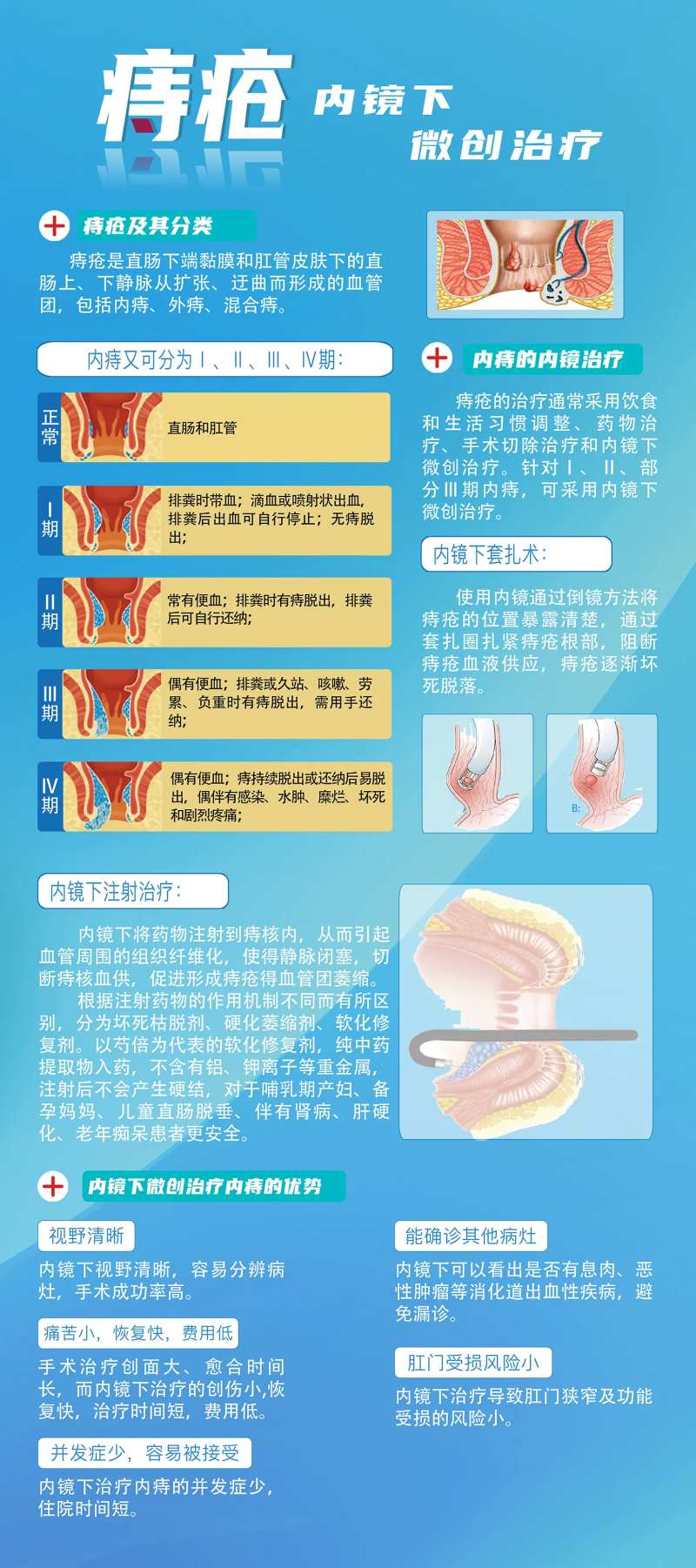 痔疮内镜治疗微创海报-采灵感-cailinggan.com