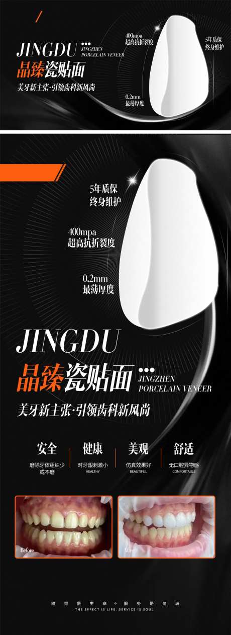 医美牙科贴面海报-采灵感-https://www.cailinggan.com/