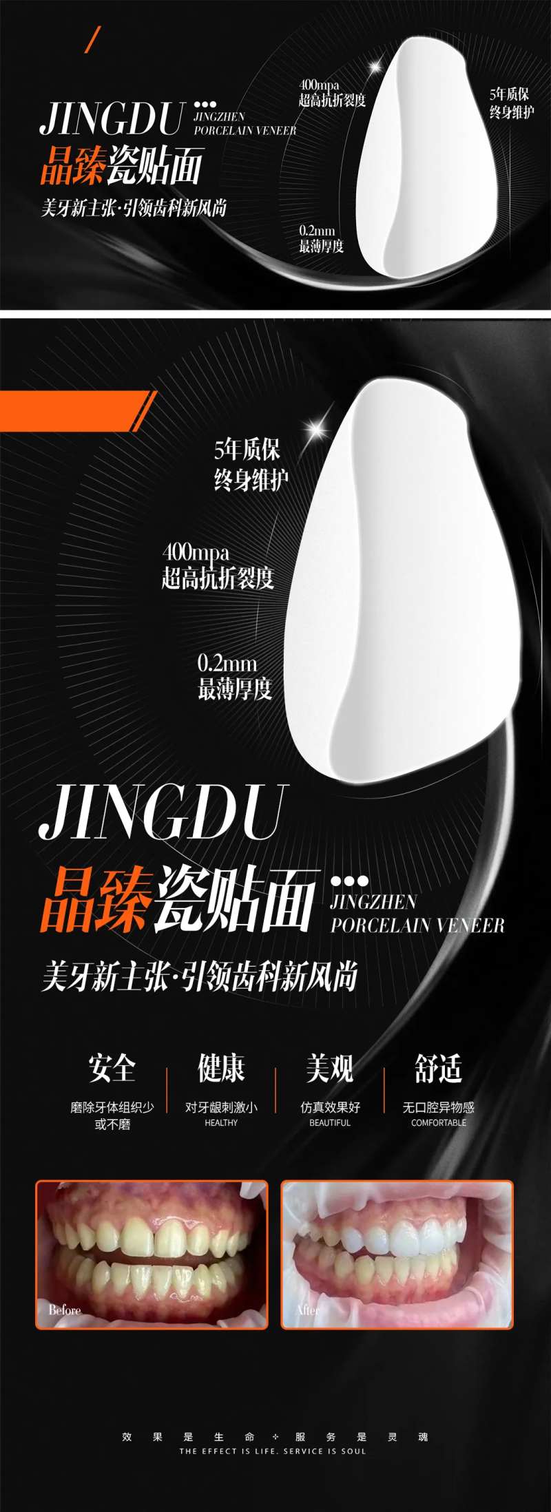 医美牙科贴面海报-采灵感-cailinggan.com
