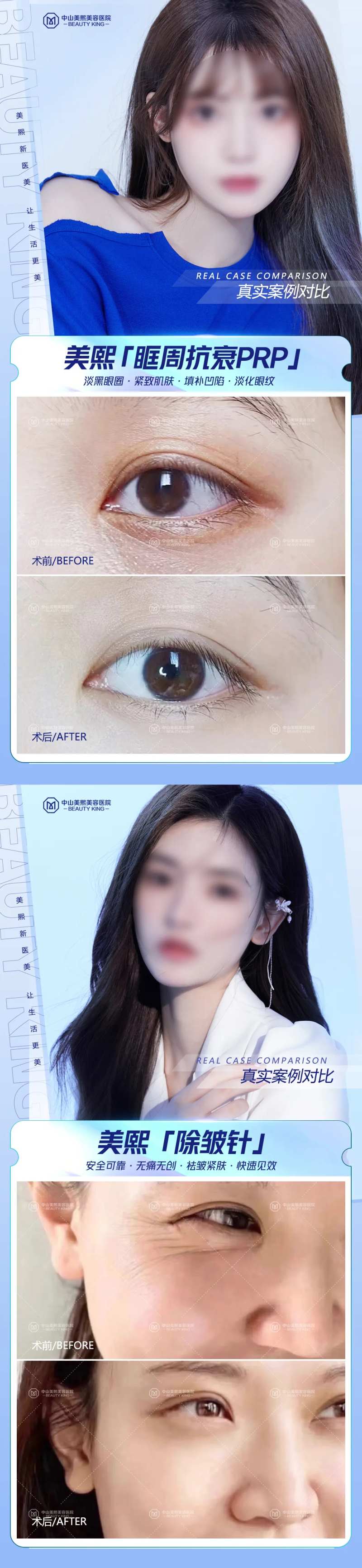 医美眼周抗衰案例海报-采灵感-cailinggan.com