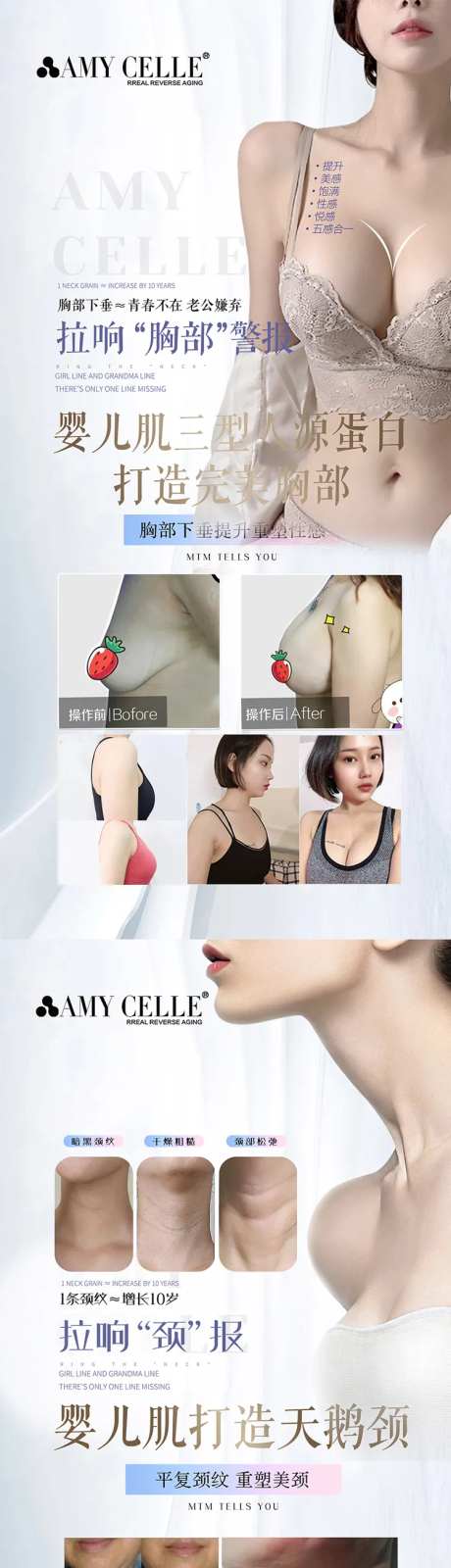 医美抗衰人源蛋白项目海报-采灵感-https://www.cailinggan.com/