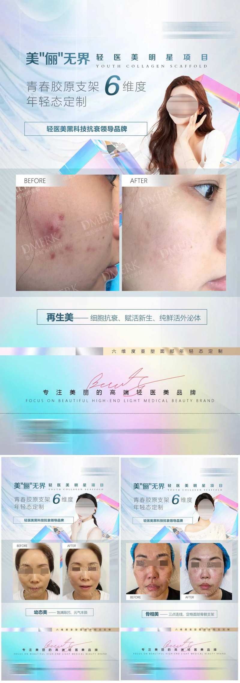 医美面部品项对比图系列海报-采灵感-cailinggan.com