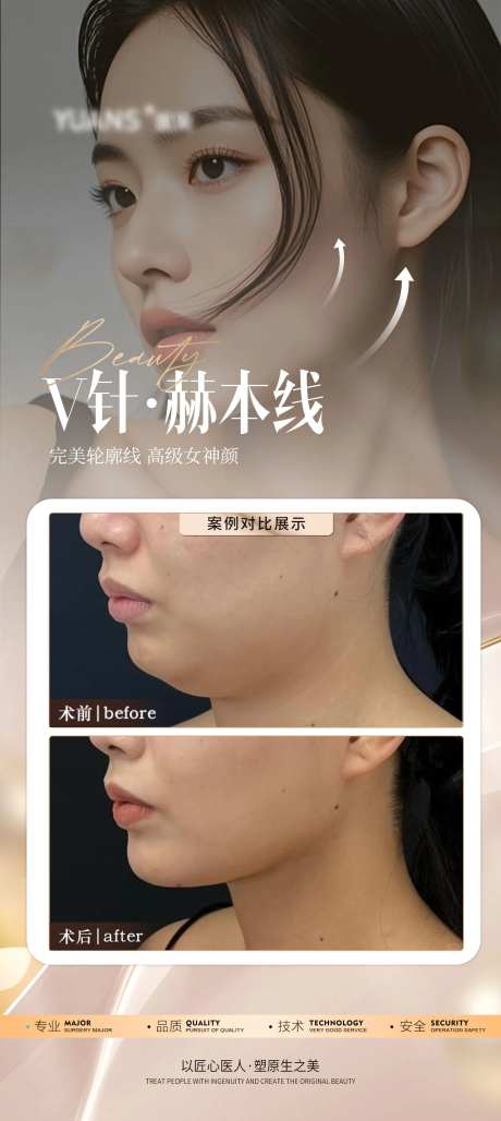 医美下颌缘案例海报-采灵感-https://www.cailinggan.com/
