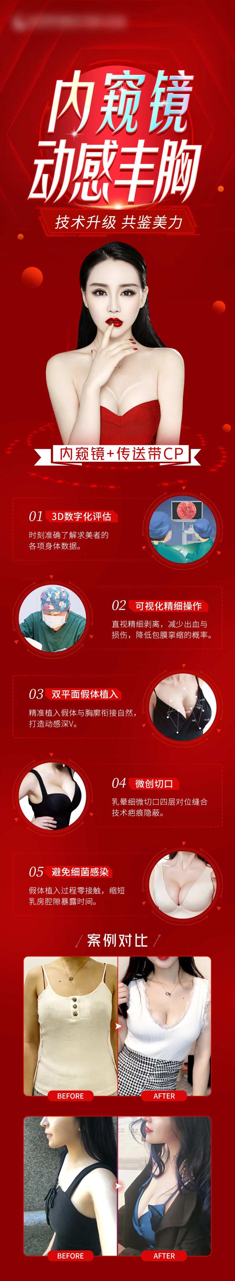 内窥镜动感丰胸长图海报-采灵感-cailinggan.com