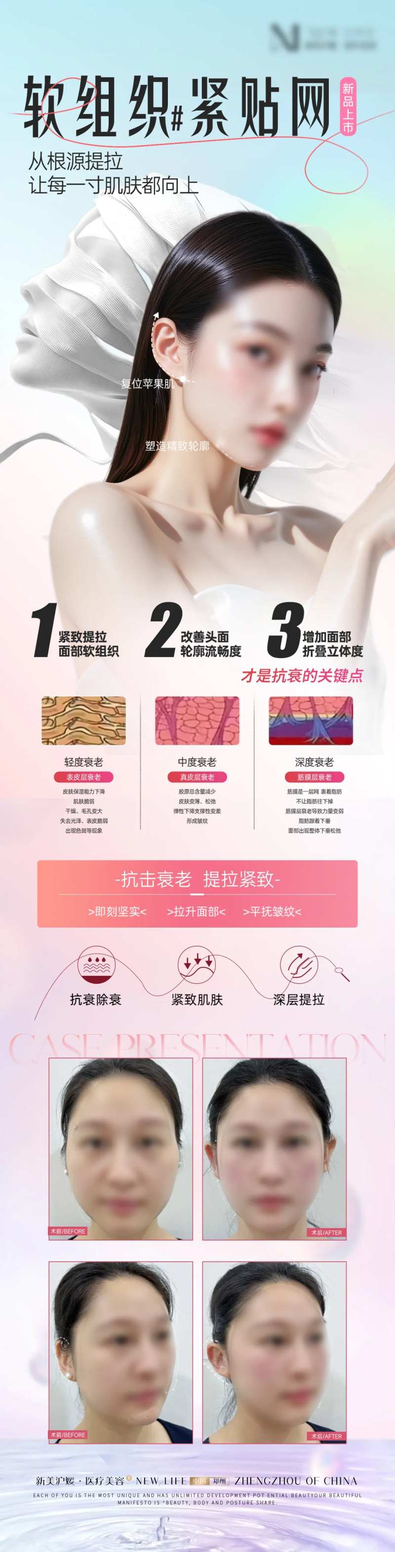 医美线雕提升抗衰品相新品海报-采灵感-cailinggan.com
