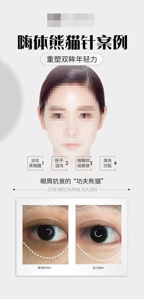 嗨体熊猫案例对比海报-采灵感-https://www.cailinggan.com/