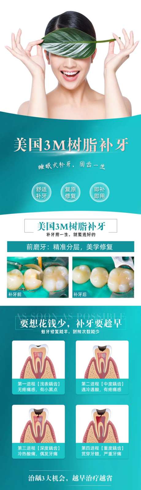 树脂补牙详情页-采灵感-https://www.cailinggan.com/