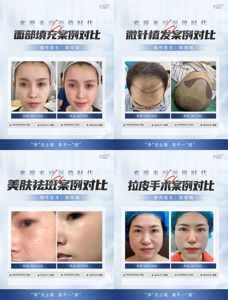 整形案例植发合集-采灵感-cailinggan.com